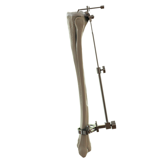 ویژگی‌های تخصصی پروتز زانوی KneeTA: